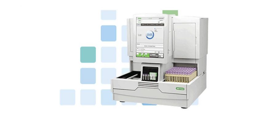 RFID Reader Embedded in High Performance Liquid Chromatograhy